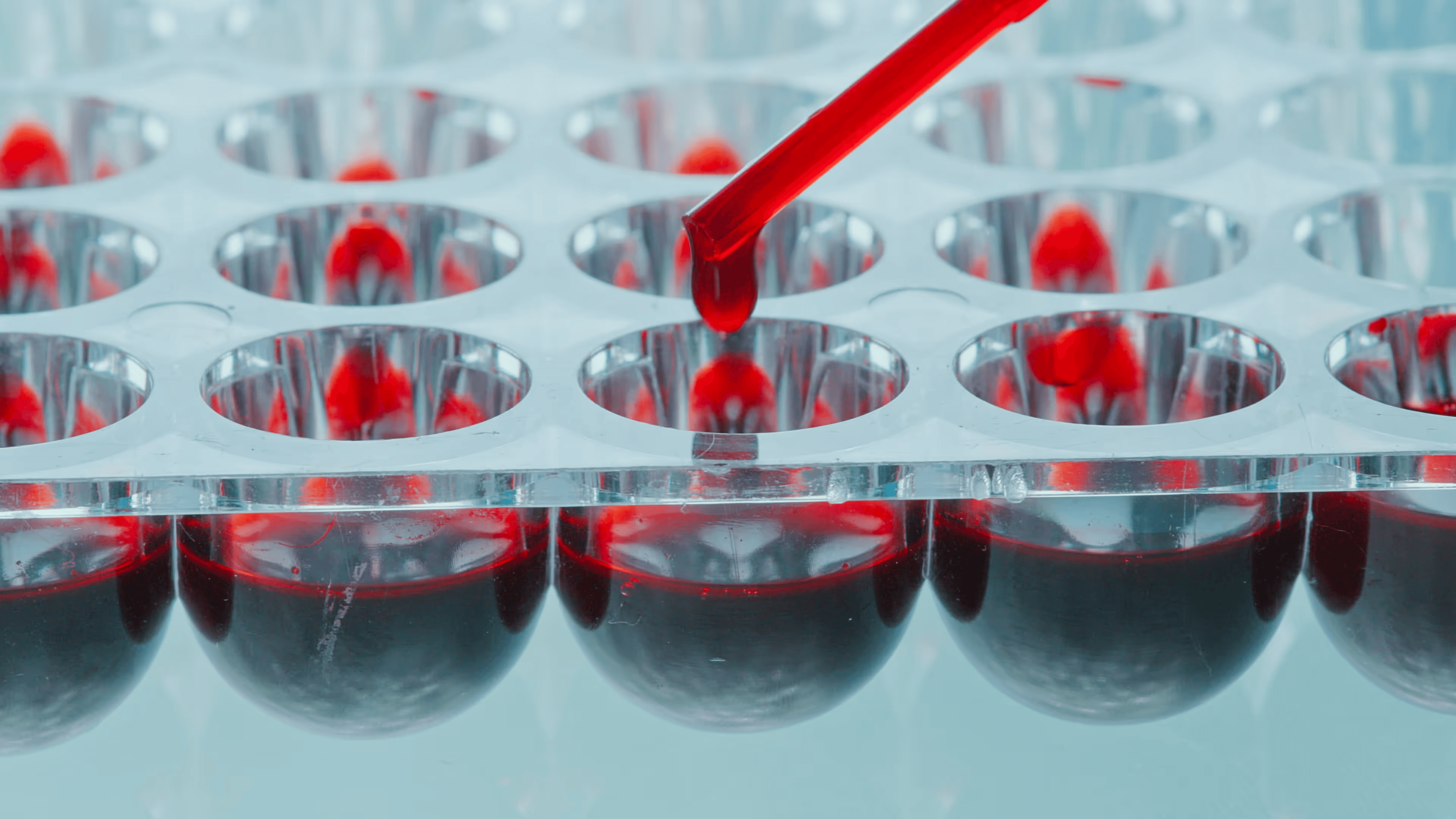 Laboratory blood sample vials being prepared for a diagnostic panel