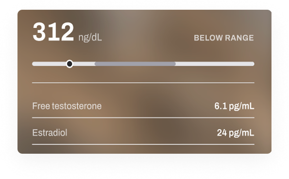 Testosterone lab result panel showing below-optimal range