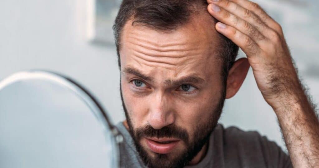 Why Do Men Go Bald The Truth About Testosterone And Hair Loss 0614