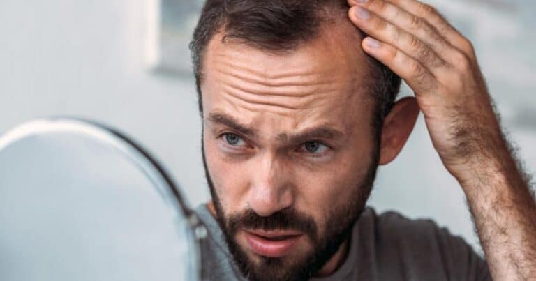 Why Do Men Go Bald: The Truth About Testosterone And Hair Loss